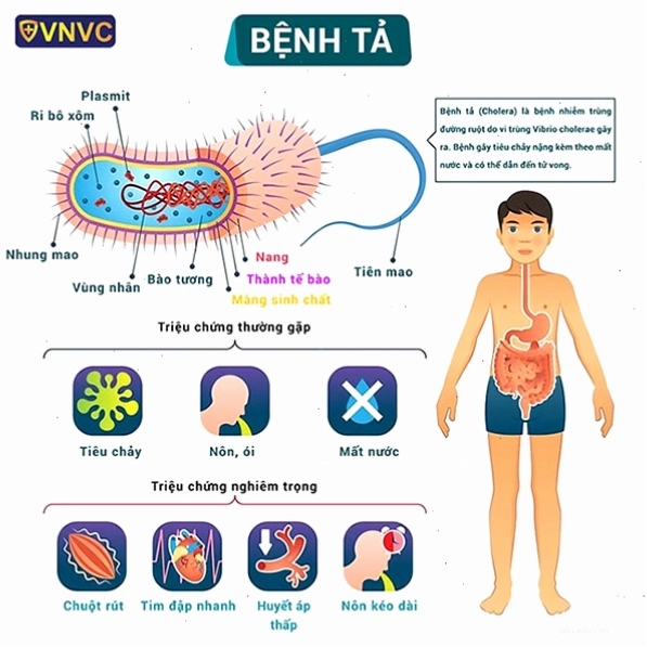 Nguyên nhân gây ra bệnh tả
