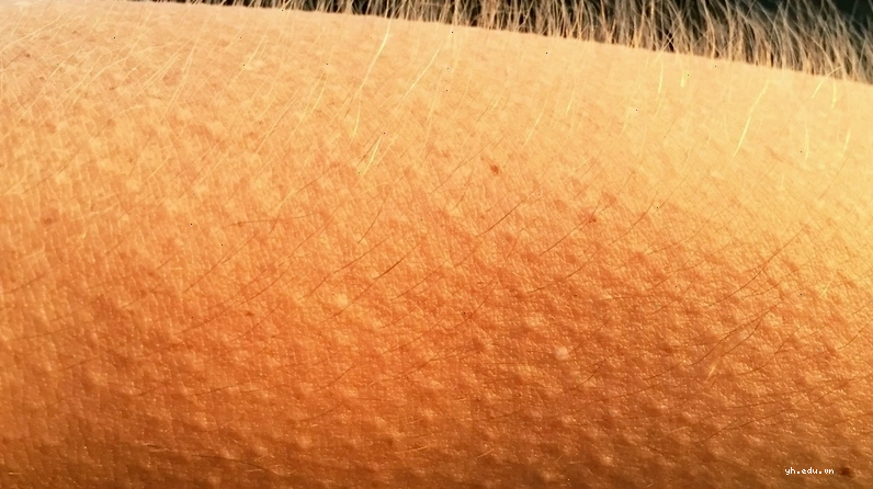 Nguyên nhân khiến bạn bị sởn gai ốc 1
