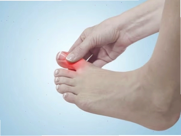 Nguyên nhân ngón chân cái bị tê mất cảm giác