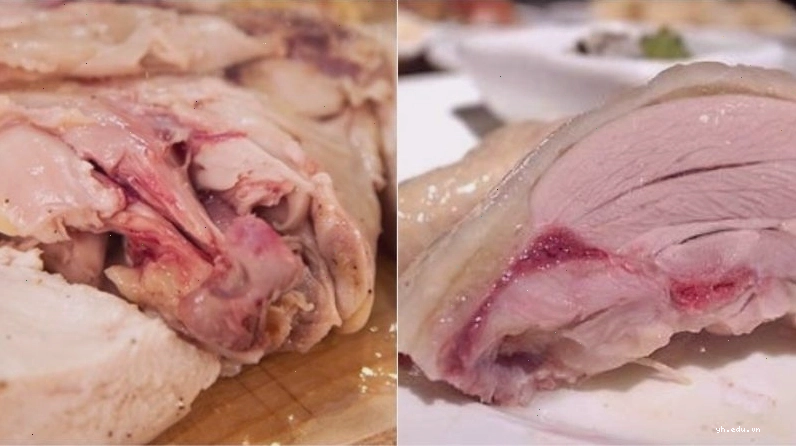 Nguyên nhân nhiễm vi khuẩn campylobacter 3