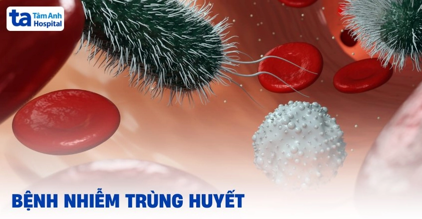 Nhiễm trùng đường huyết là bệnh gì và các thông tin y khoa cần biết