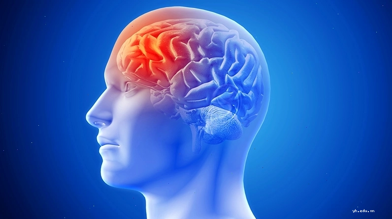 Những người có tiền sử bị chấn thương sọ não thường có nguy cơ mắc bệnh cao hơn so với người bình thường