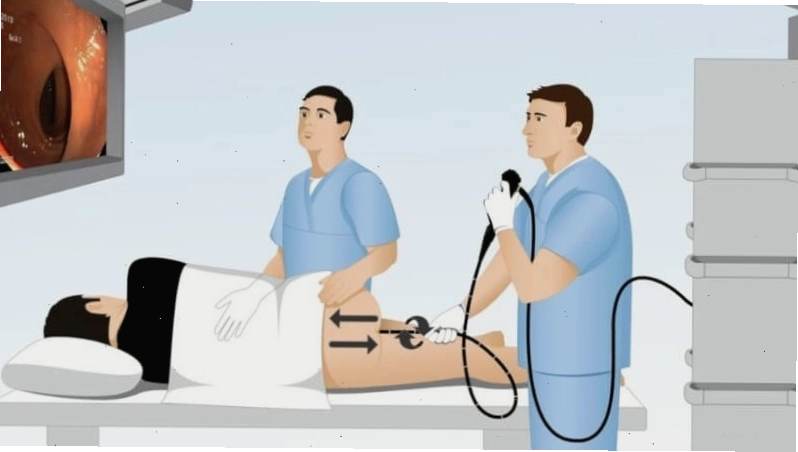 Nội soi trực tràng để chẩn đoán