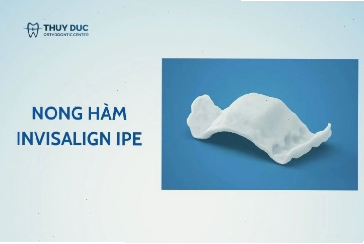 Nong hàm Invisalign IPE