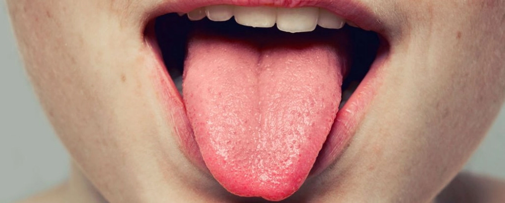 Nước miếng mặn là bệnh gì và những nguyên nhân tiềm ẩn cần lưu ý