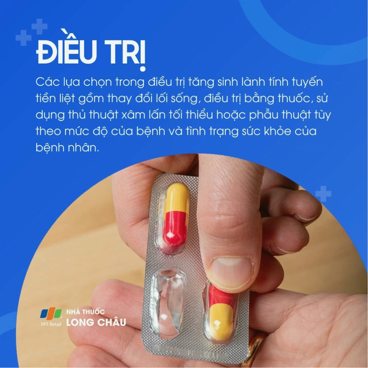Phác đồ điều trị nội khoa và can thiệp y tế đối với bệnh tuyến tiền liệt