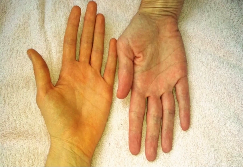 Phân tích các nguyên nhân dẫn đến tình trạng vàng da