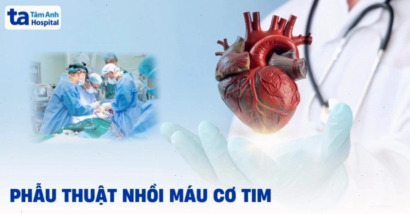 Phẫu thuật cấp cứu cho bệnh nhân nhồi máu cơ tim