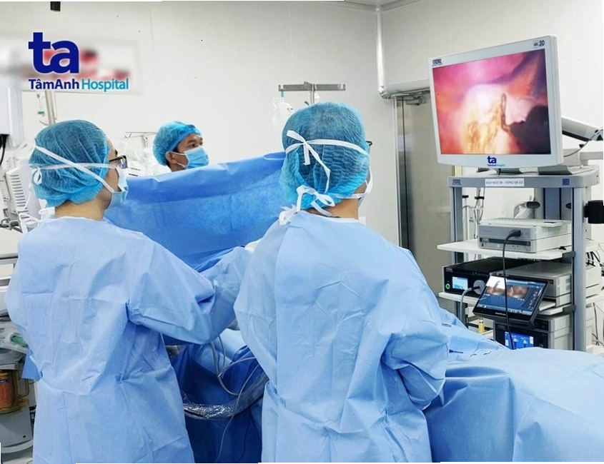 Phẫu thuật cắt hạch giao cảm điều trị tăng tiết mồ hôi