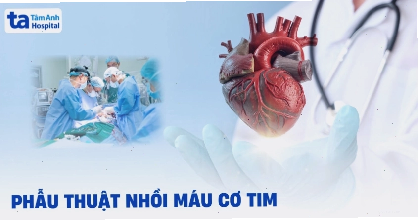 Phẫu thuật nhồi máu cơ tim