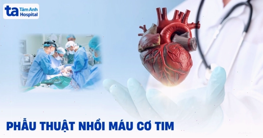 Phẫu thuật tim mạch