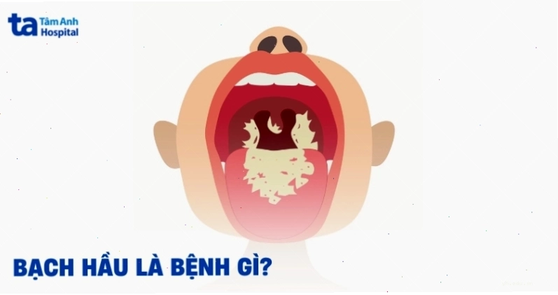 Phòng ngừa bệnh truyền nhiễm