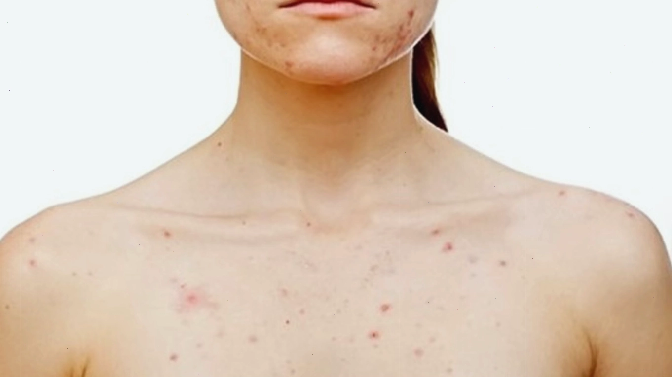 Phương pháp chăm sóc da vùng ngực đúng cách