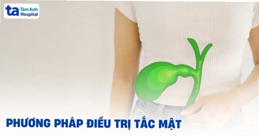 Phương pháp điều trị tắc mật