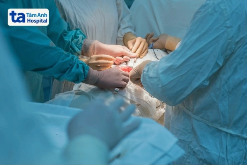 Phương pháp điều trị u mô đệm đường tiêu hóa