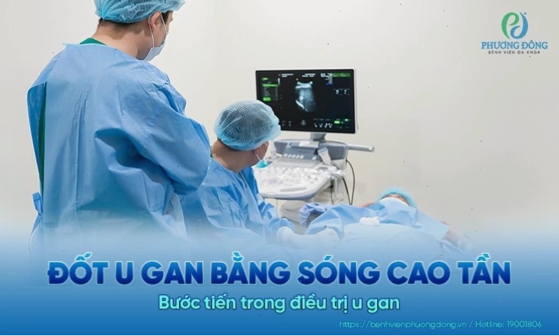Phương pháp đốt u gan bằng sóng cao tần