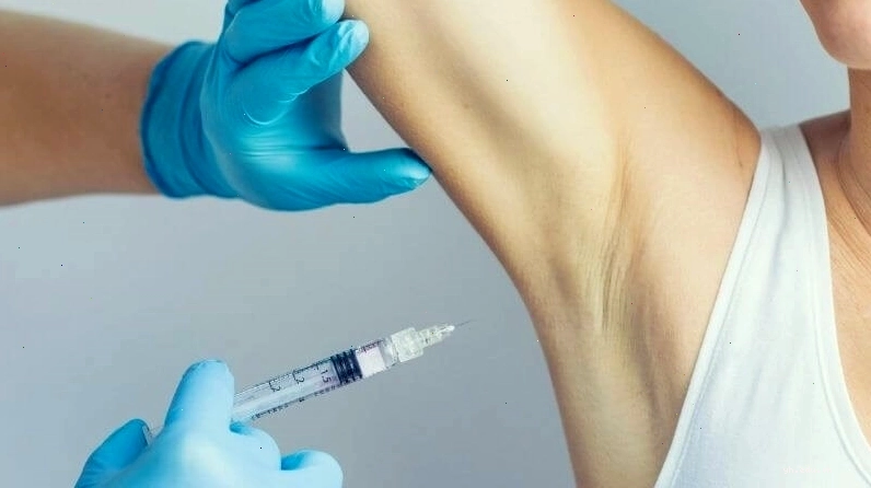 Phương pháp tiêm botox hỗ trợ điều trị đổ mồ hôi