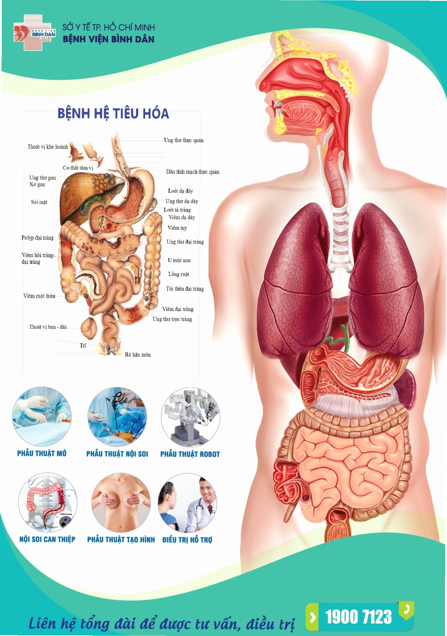 Poster giới thiệu tổng quan về các bệnh lý tiêu hóa thường gặp