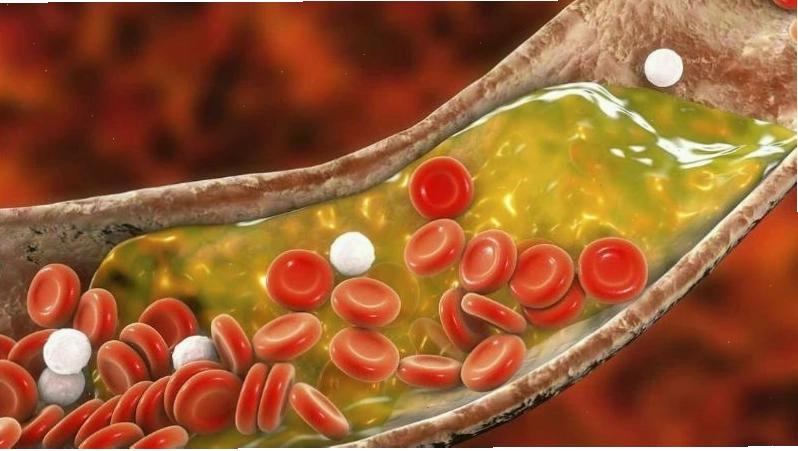 Quả khế giúp đào thải cholesterol