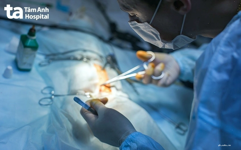 Quy trình điều trị viêm túi thừa tại bệnh viện