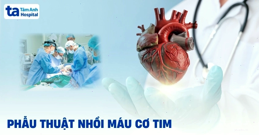 Quy trình phẫu thuật nhồi máu cơ tim cấp cứu