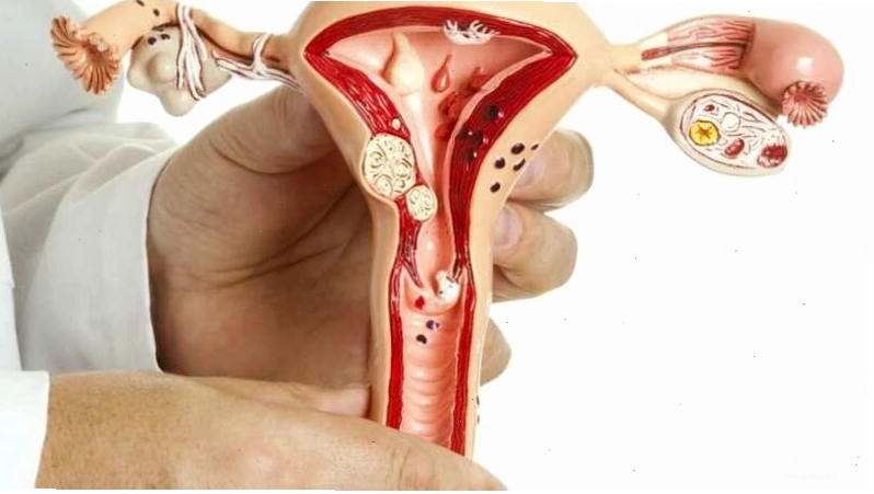 Rong kinh đi kèm với cường kinh gây mất nhiều máu