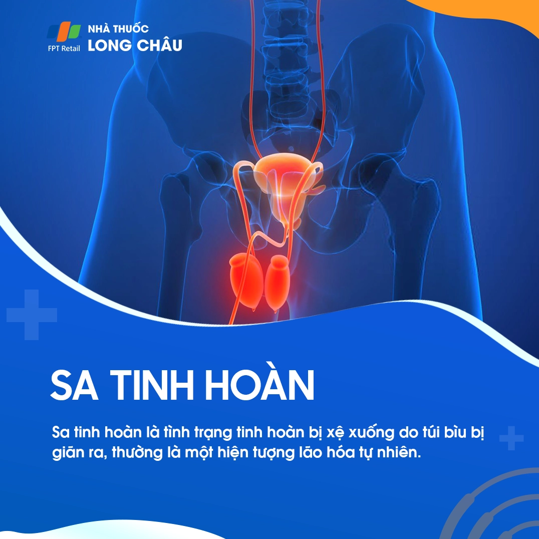 Sa cà là bệnh gì và những kiến thức quan trọng cần lưu ý