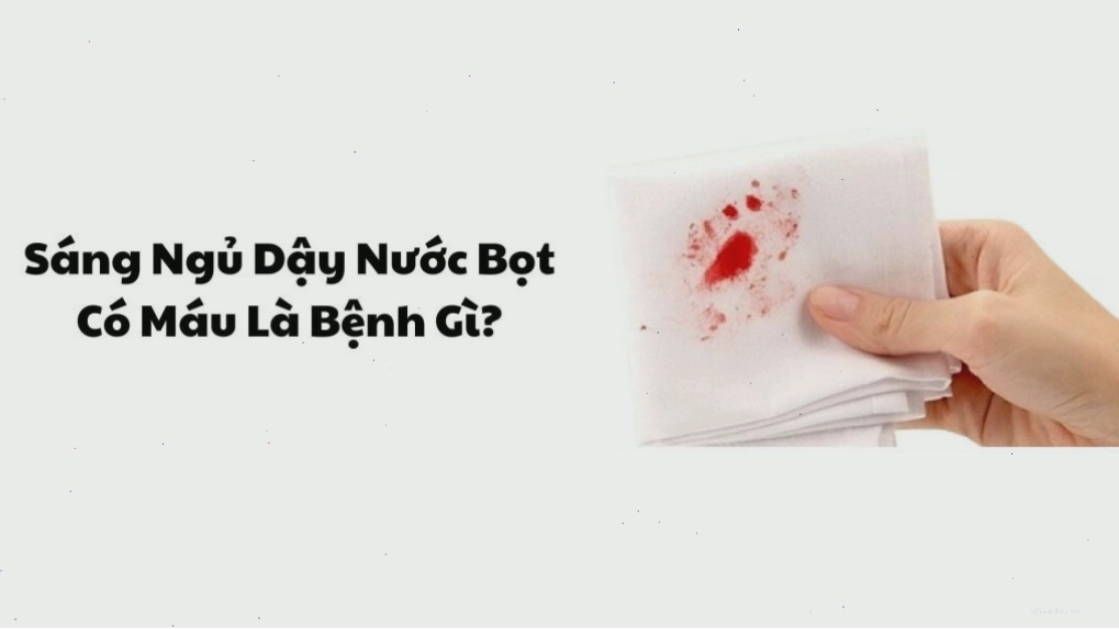 Sáng Ngủ Dậy Nước Bọt Có Máu