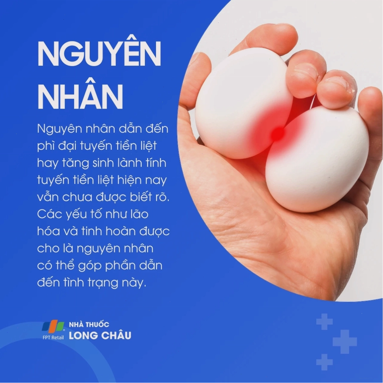 Sơ đồ minh họa quá trình thay đổi nội tiết tố tác động đến tuyến tiền liệt