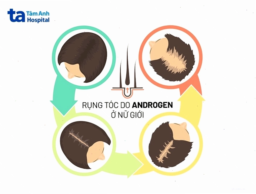 Sơ đồ mô phỏng nội tiết tố ảnh hưởng đến chu kỳ phát triển của nang tóc