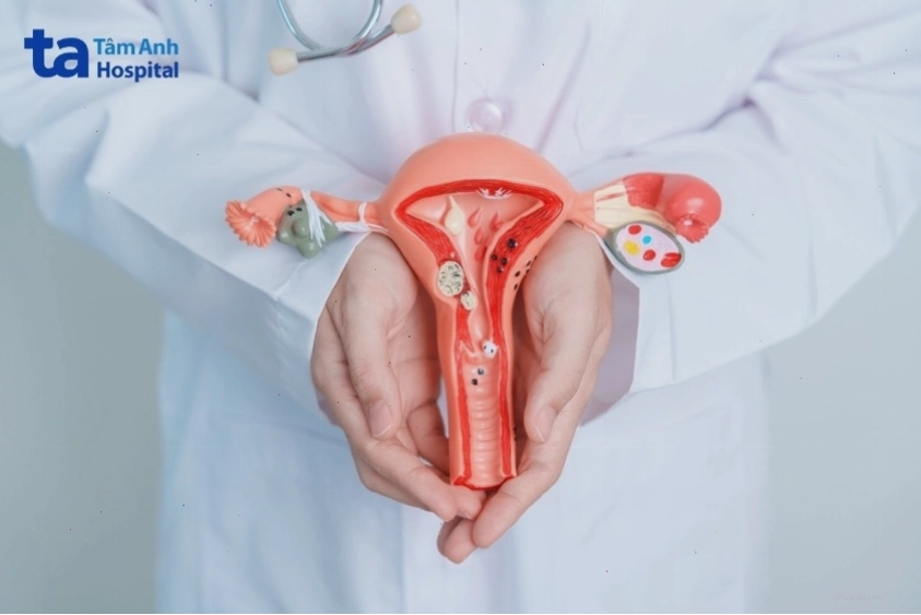 Sơ đồ tác động của cường giáp đến trục hạ đồi