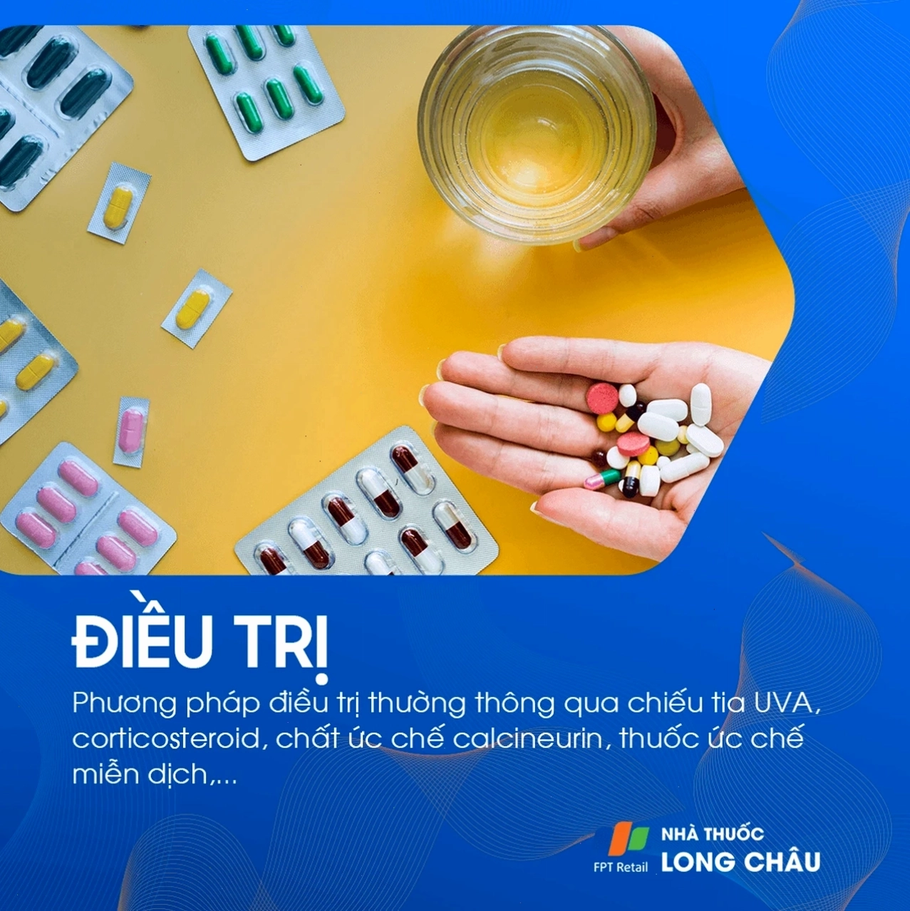 Sử dụng thuốc steroid giảm viêm