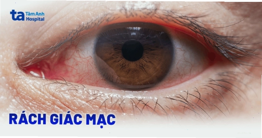 Sức khỏe cơ thể có mối liên hệ mật thiết