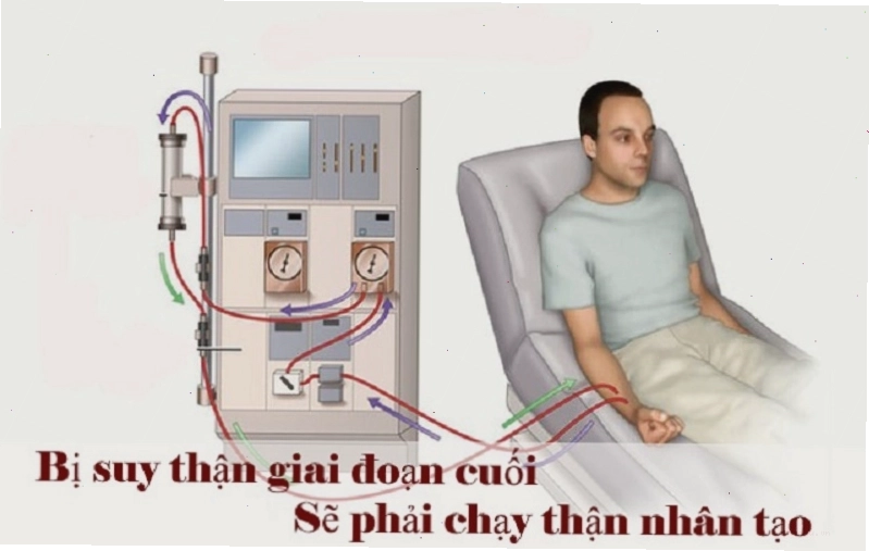 Suy thận gây ảnh hưởng nghiêm trọng đến sức khỏe