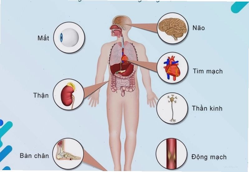 Tăng đường huyết thường xuyên có thể gây ra nhiều biến chứng nguy hiểm