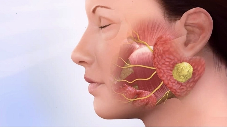 Tăng tiết nước bọt bất thường là dấu hiệu bệnh lý