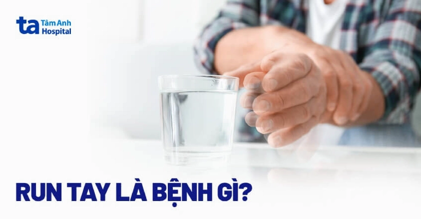 Tay bị run nhẹ là bệnh gì và những điều cần biết để bảo vệ thần kinh
