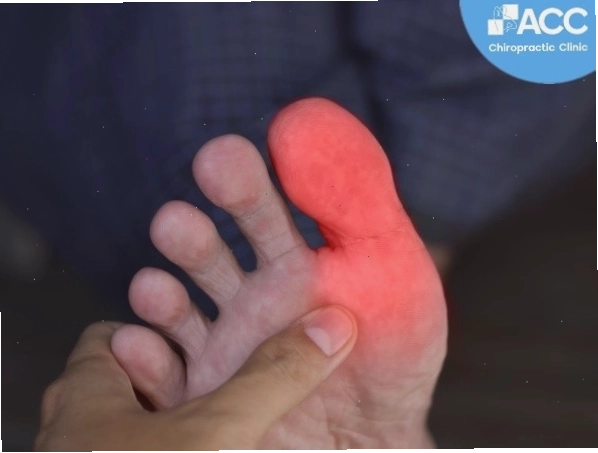 Tê đầu ngón chân cái bên trái ảnh hưởng đến khả năng đi lại