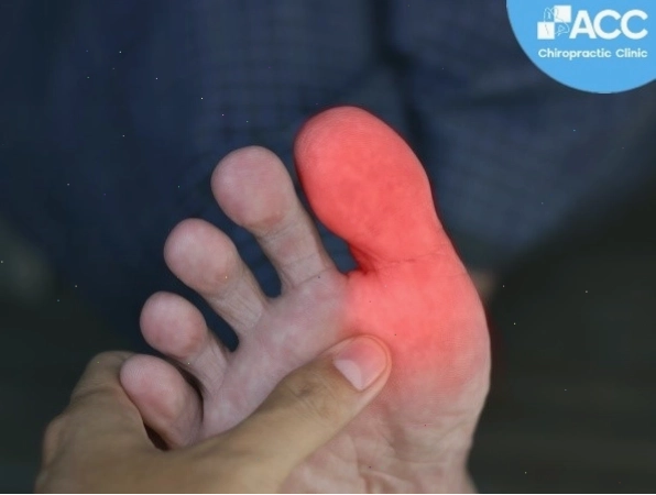 Tê đầu ngón chân cái bên trái là biểu hiện cần theo dõi sát sao