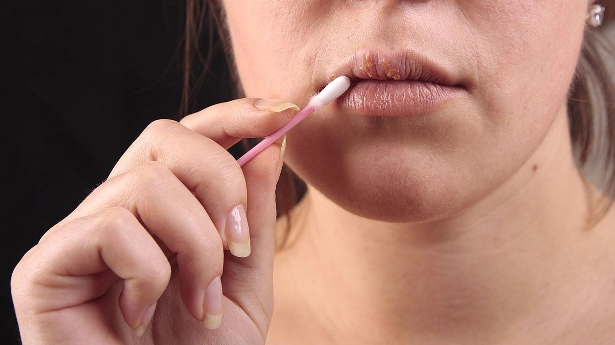 Tê miệng là bệnh gì và những lưu ý y khoa quan trọng cần biết