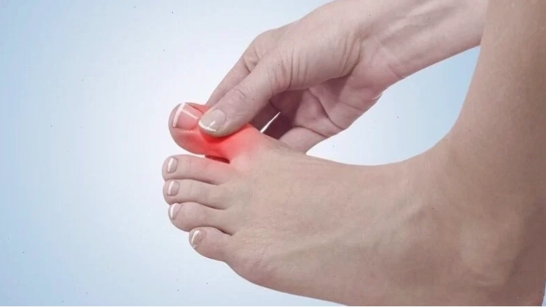 Tê ngón chân cái có thể đi kèm với cảm giác nóng rát hoặc đau nhói