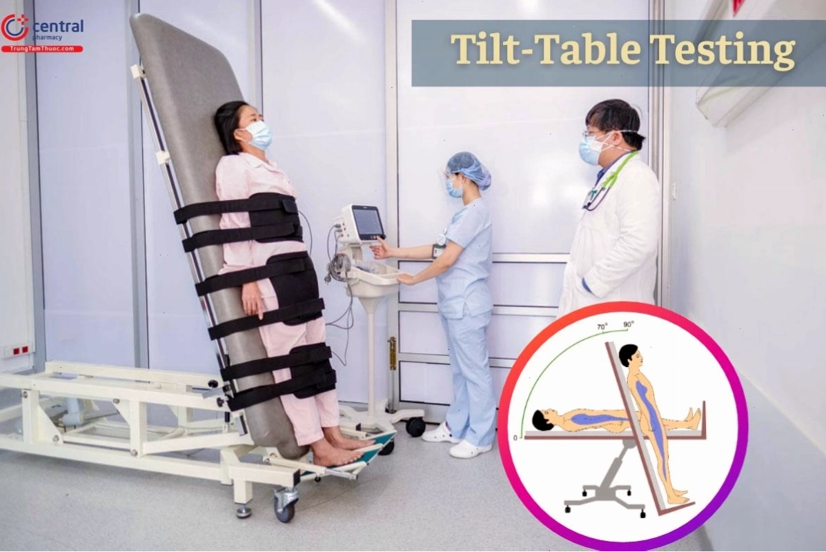 Test bàn nghiêng để chẩn đoán