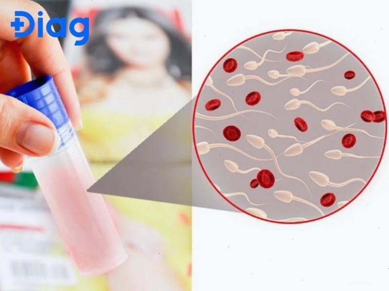 Thăm khám nam khoa sớm giúp bảo vệ sức khỏe sinh sản