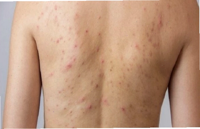 Thay đổi nội tiết tố ở nam giới