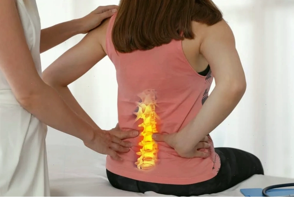 Thoát vị đĩa đệm gây nóng rát lưng