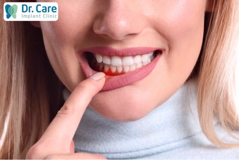 Thói quen nhai đá khiến răng nhạy cảm hơn