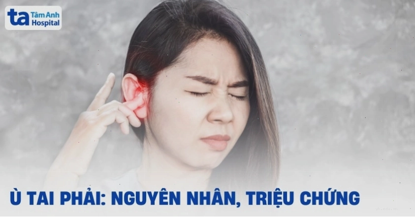 Thông tin về tình trạng ù tai phải