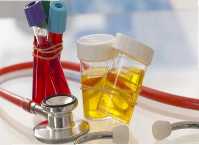 Thực hiện xét nghiệm nước tiểu là một phương pháp giúp chẩn đoán chứng đau bàng quang