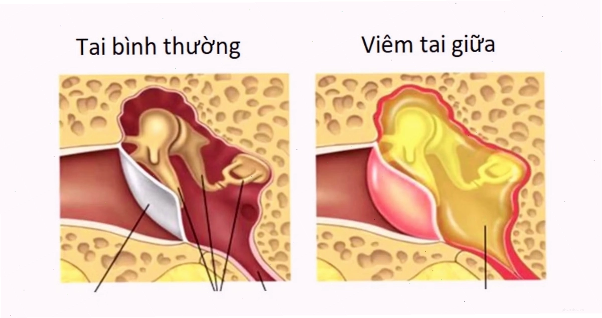 Thực phẩm tươi sạch hỗ trợ tăng cường hệ miễn dịch