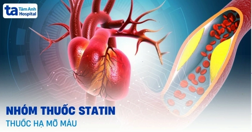 Thuốc hạ mỡ máu nhóm Statin